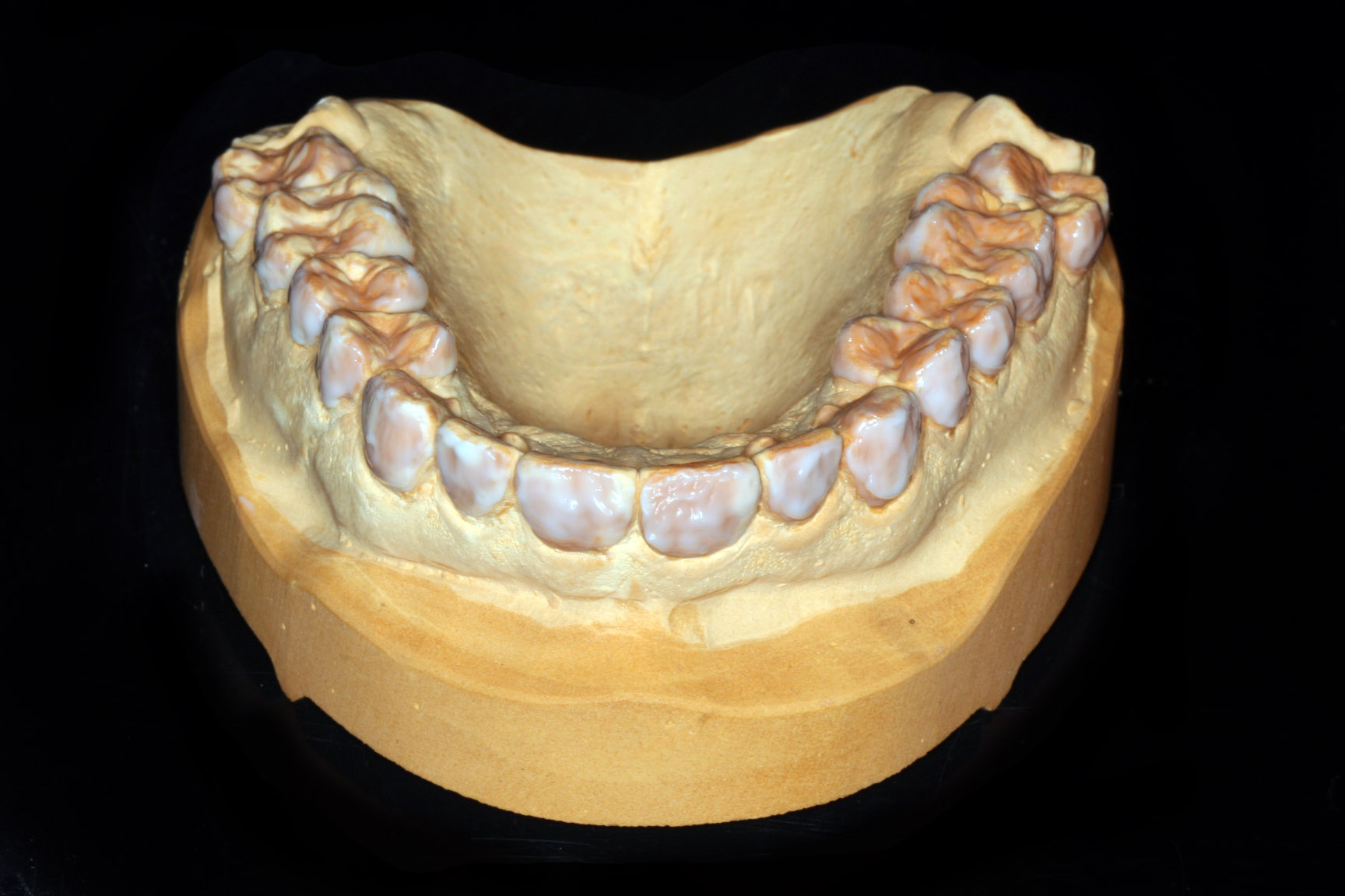 Oberkiefermodell mit vorbereiteten Zahnflächen