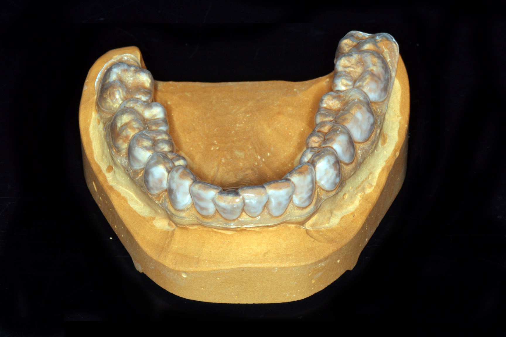 Fertige Fluoridierungsschiene